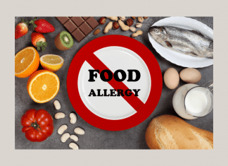 different foods with a "FOOD ALLERGY" sign crossed out in center