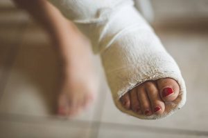 Woman with broken leg: selective focus on the feet